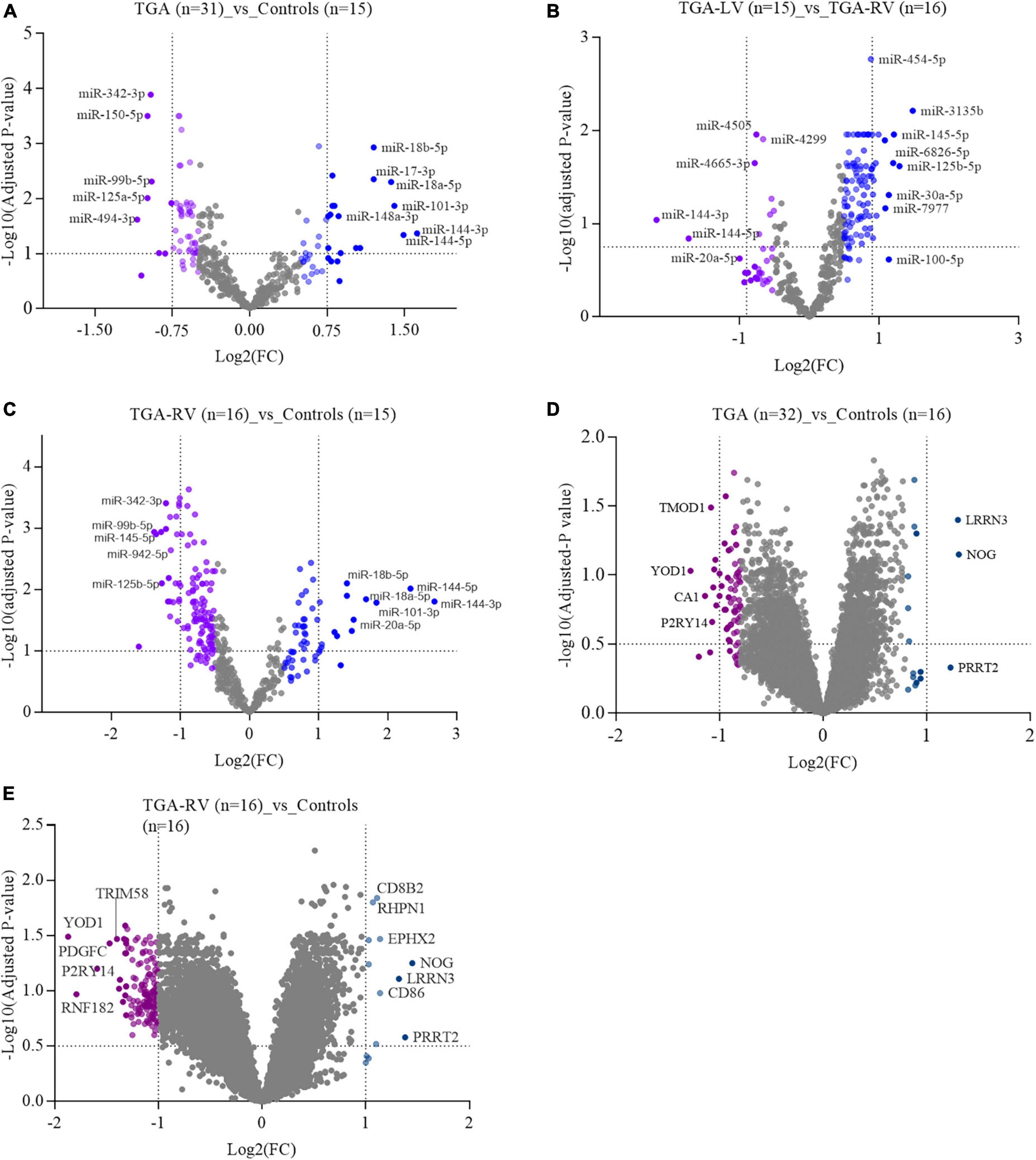 Expression profiling analysis reveals key microRNA–mRNA interactions in patients with transposition of the great arteries and systemic left and right ventricles